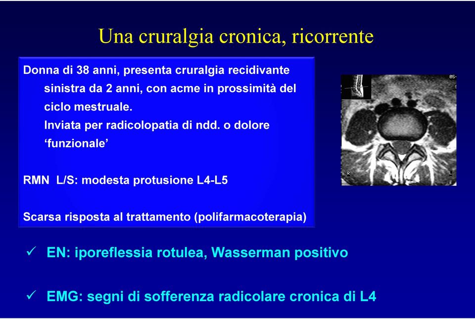 o dolore funzionale RMN L/S: modesta protusione L4-L5 Scarsa risposta al trattamento