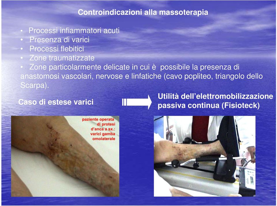 la presenza di anastomosi vascolari, nervose e linfatiche (cavo popliteo, triangolo