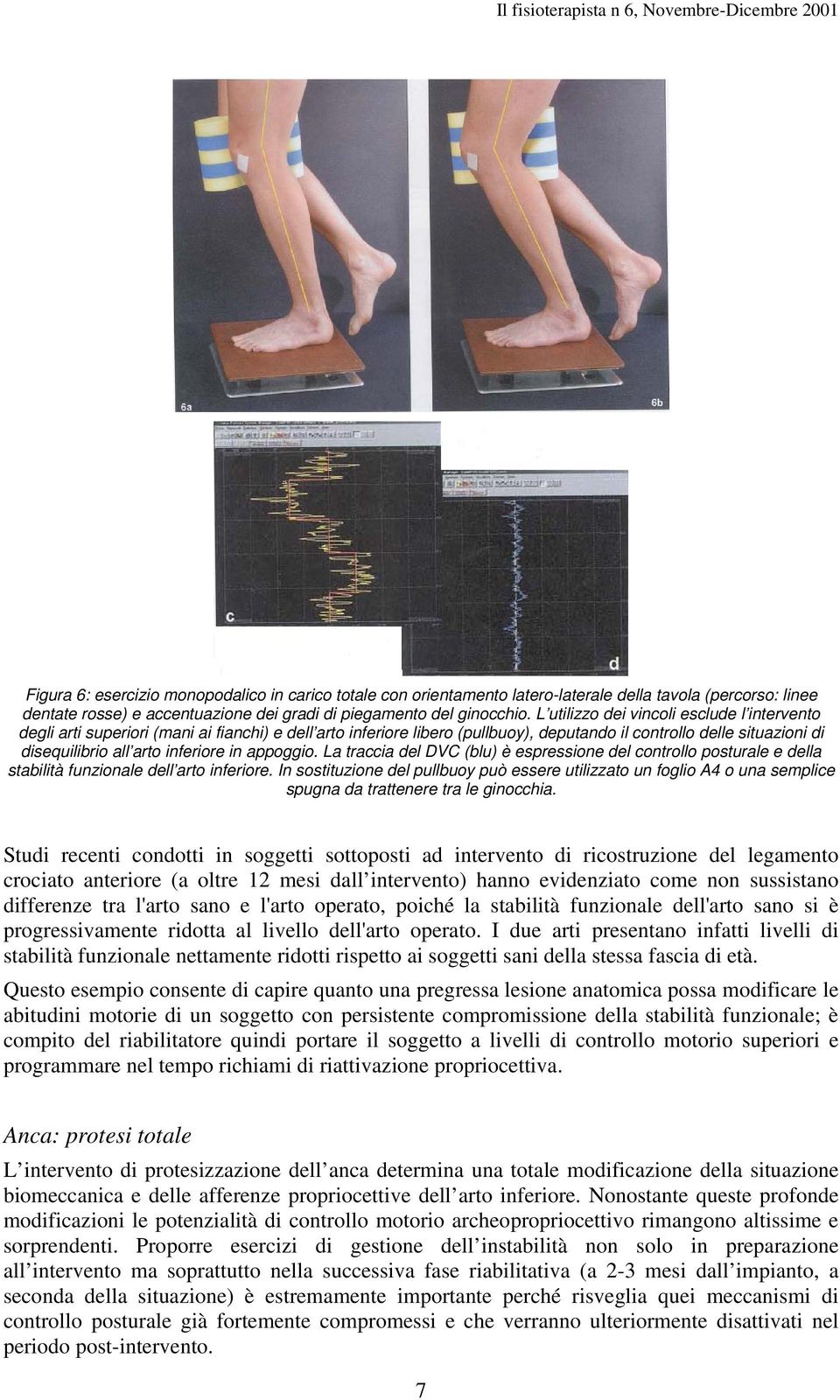 in appoggio. La traccia del DVC (blu) è espressione del controllo posturale e della stabilità funzionale dell arto inferiore.