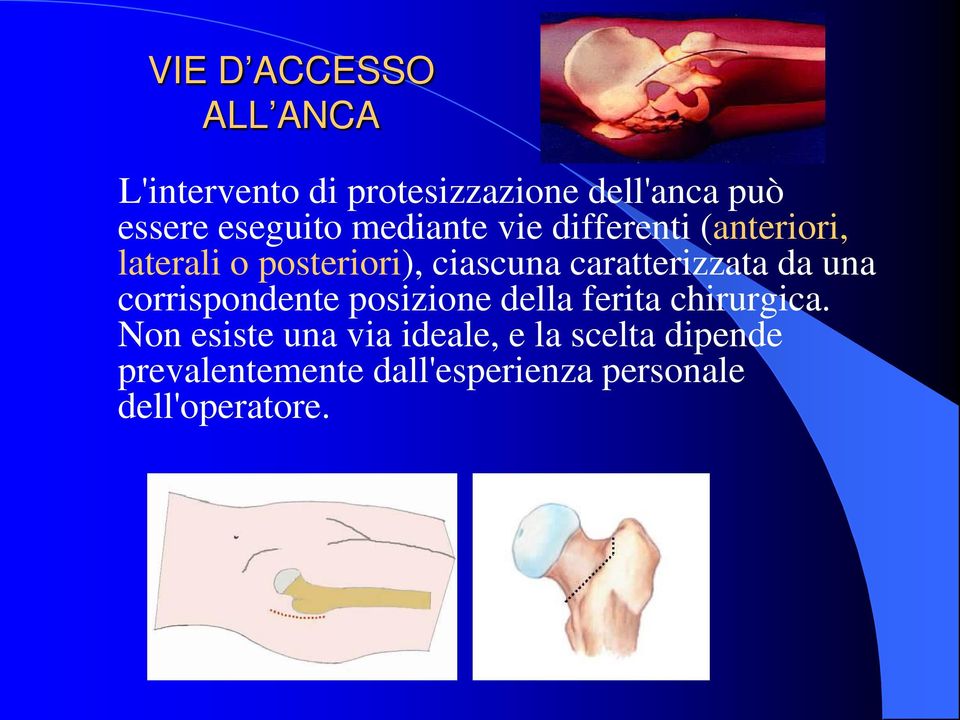 caratterizzata da una corrispondente posizione della ferita chirurgica.