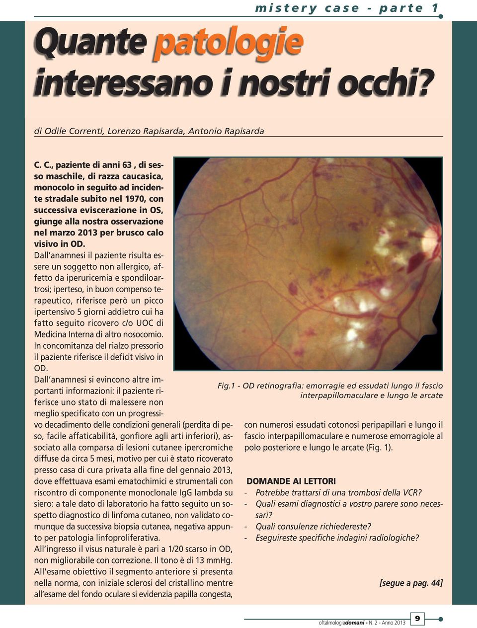 C., paziente di anni 63, di sesso maschile, di razza caucasica, monocolo in seguito ad incidente stradale subito nel 1970, con successiva eviscerazione in OS, giunge alla nostra osservazione nel