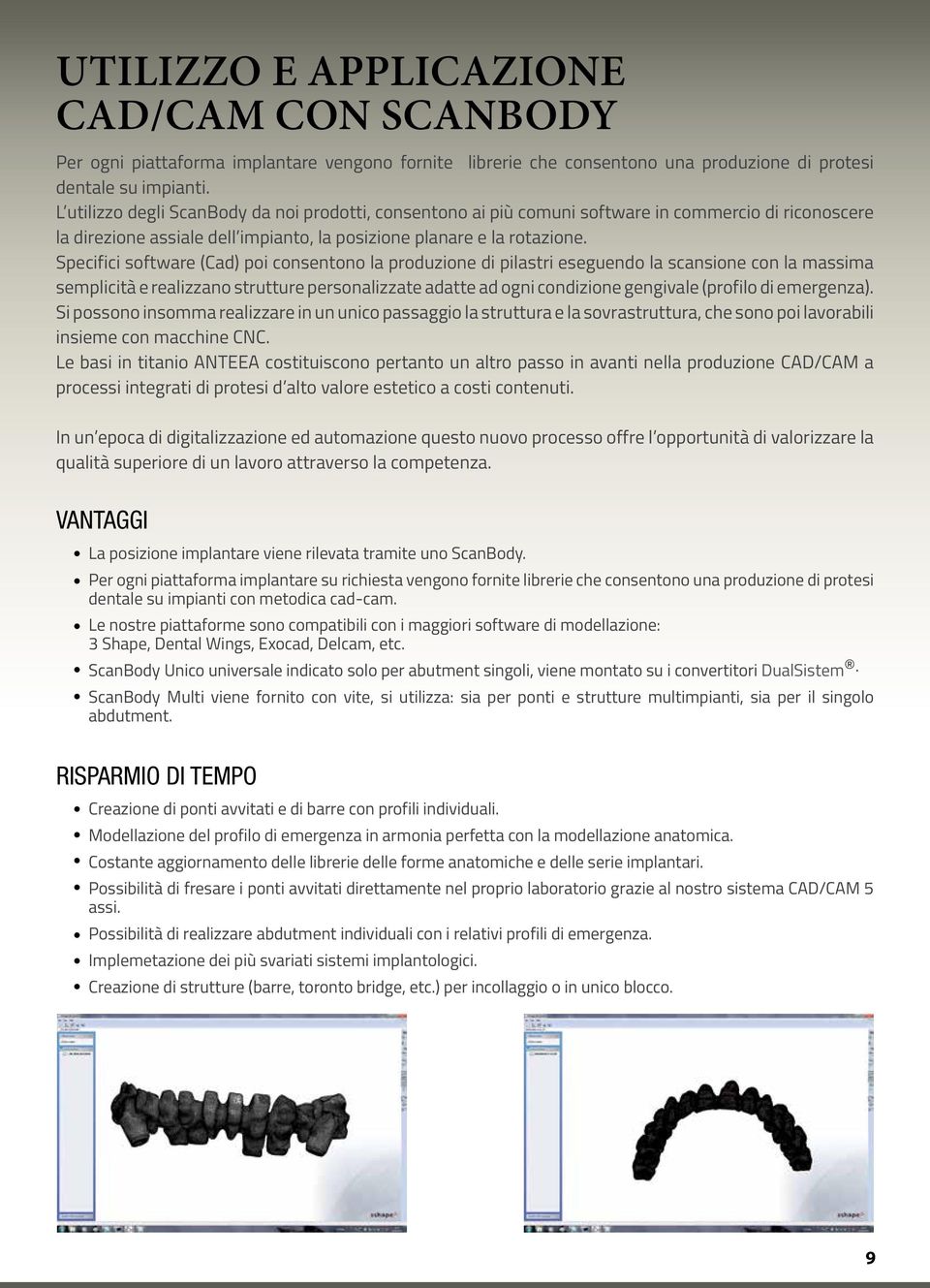 Specifici software (Cad) poi consentono la produzione di pilastri eseguendo la scansione con la massima semplicità e realizzano strutture personalizzate adatte ad ogni condizione gengivale (profilo