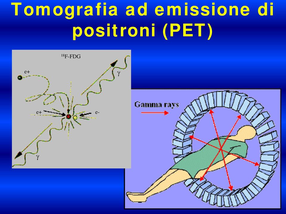 positroni (PET)