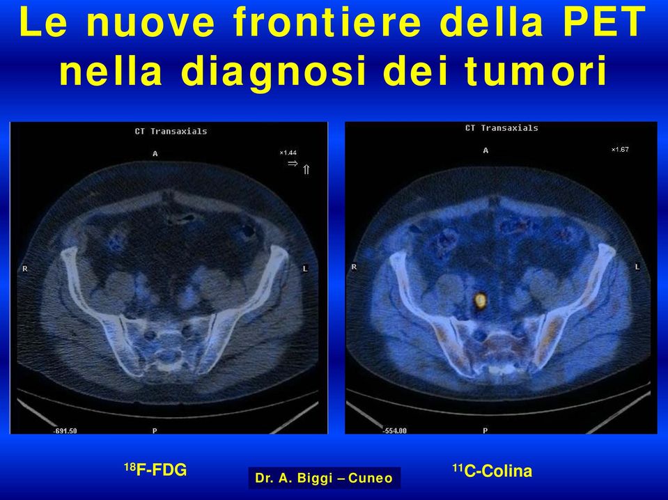 diagnosi dei tumori 18