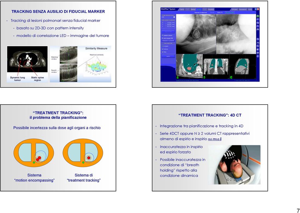 Integrazione tra pianificazione e tracking in 4D - Serie 4DCT oppure N 2 volumi CT rappresentativi almeno di espirio e inspirio normali Sistema motion encompassing