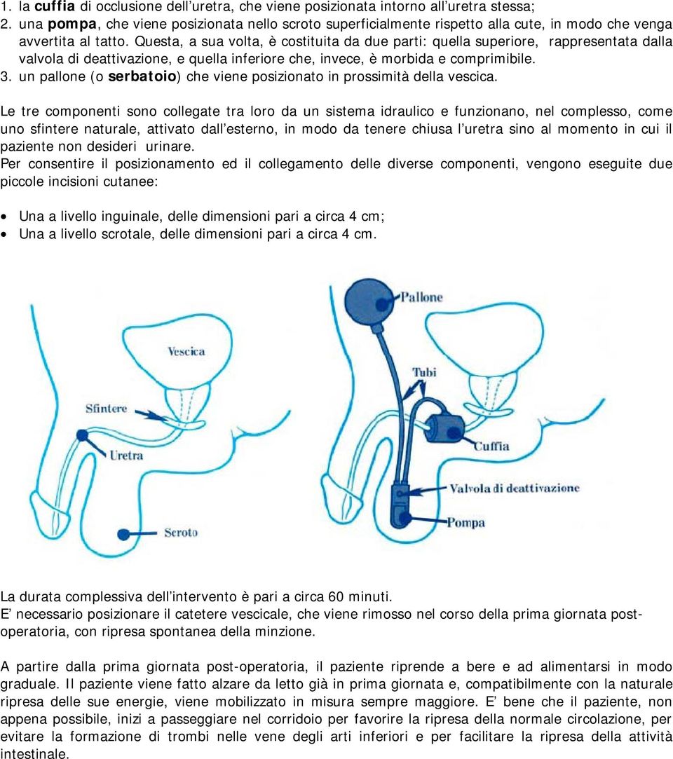 Questa, a sua volta, è costituita da due parti: quella superiore, rappresentata dalla valvola di deattivazione, e quella inferiore che, invece, è morbida e comprimibile. 3.