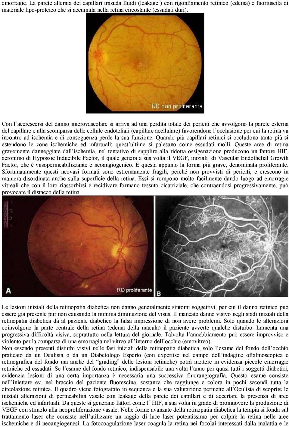 Con l accrescersi del danno microvascolare si arriva ad una perdita totale dei periciti che avvolgono la parete esterna del capillare e alla scomparsa delle cellule endoteliali (capillare acellulare)