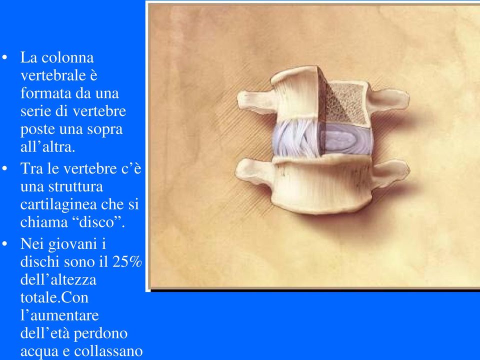 Tra le vertebre c è una struttura cartilaginea che si chiama