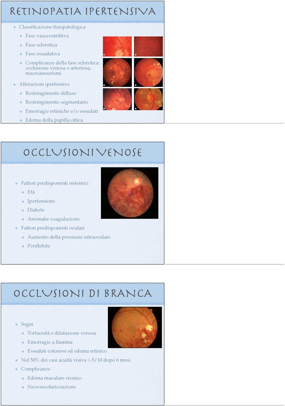 predisponenti sistemici Età Ipertensione Diabete Anomalie coagulazione Fattori predisponenti oculari Aumento della pressione intraoculare Periflebite OCCLUSIONI DI BRANCA Segni