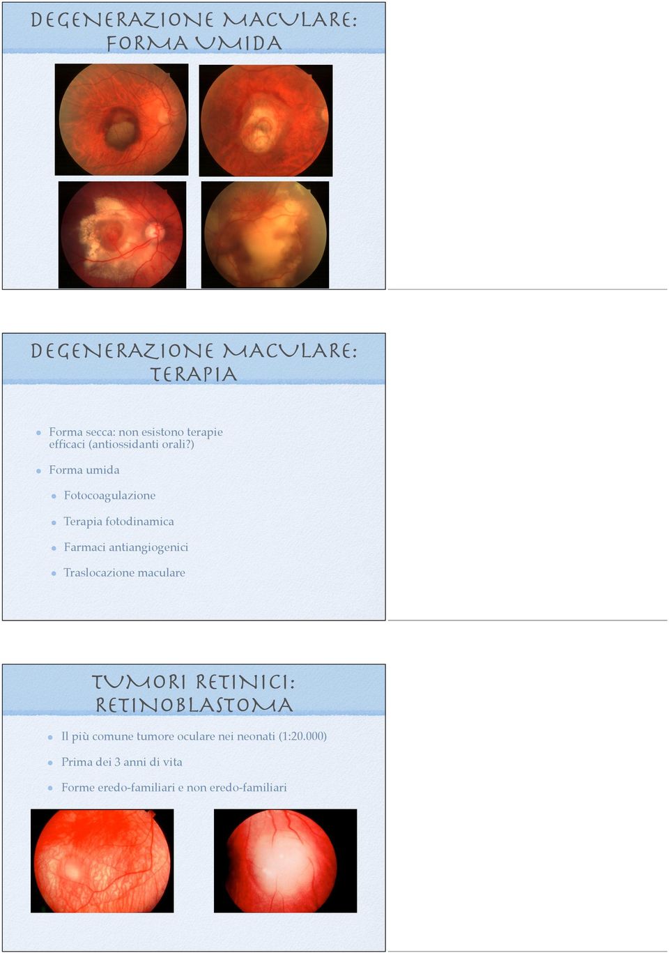 ) Forma umida Fotocoagulazione Terapia fotodinamica Farmaci antiangiogenici Traslocazione