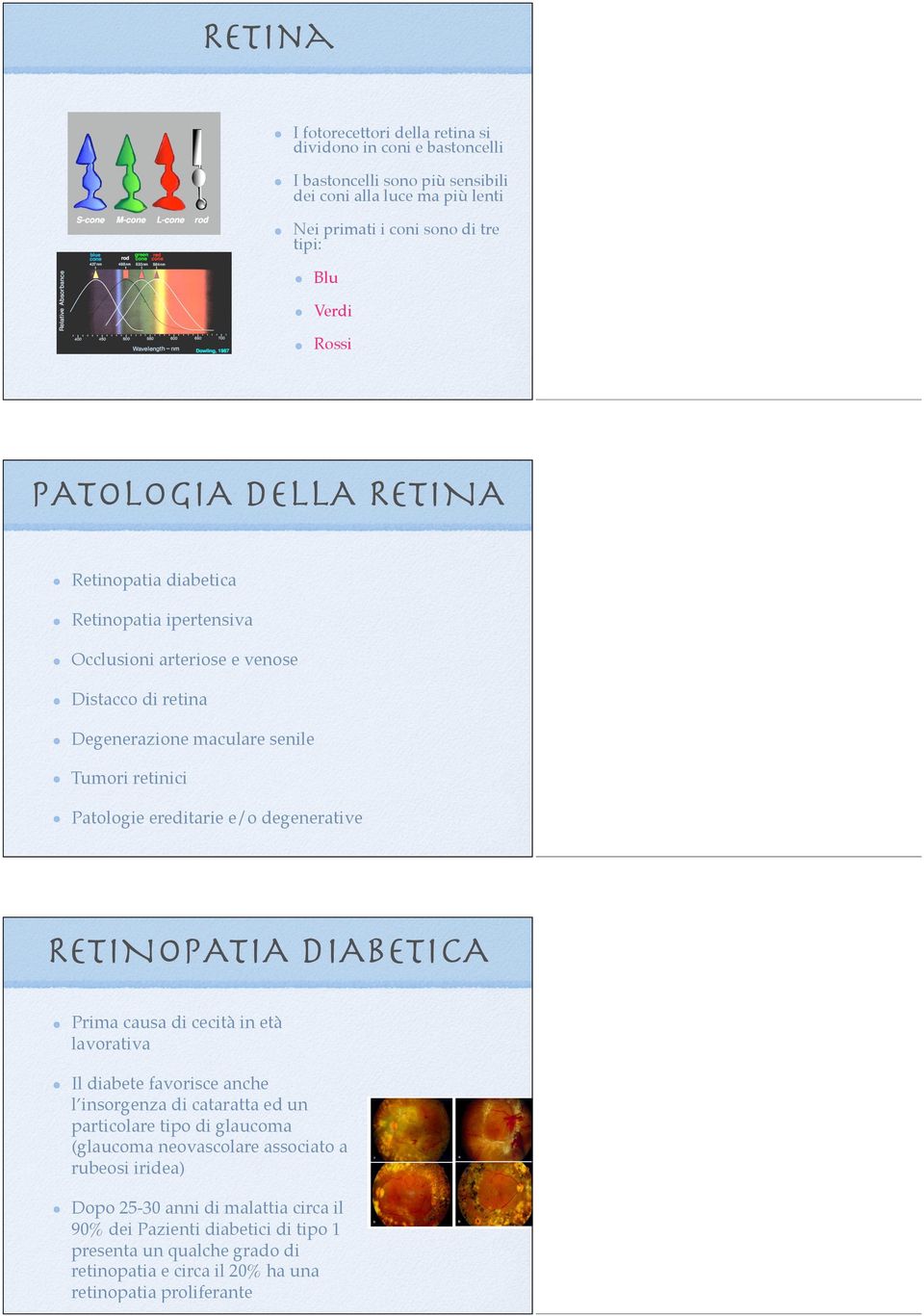 e/o degenerative RETINOPATIA DIABETICA Prima causa di cecità in età lavorativa Il diabete favorisce anche l insorgenza di cataratta ed un particolare tipo di glaucoma (glaucoma