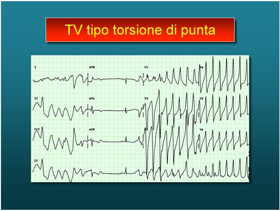 di punta