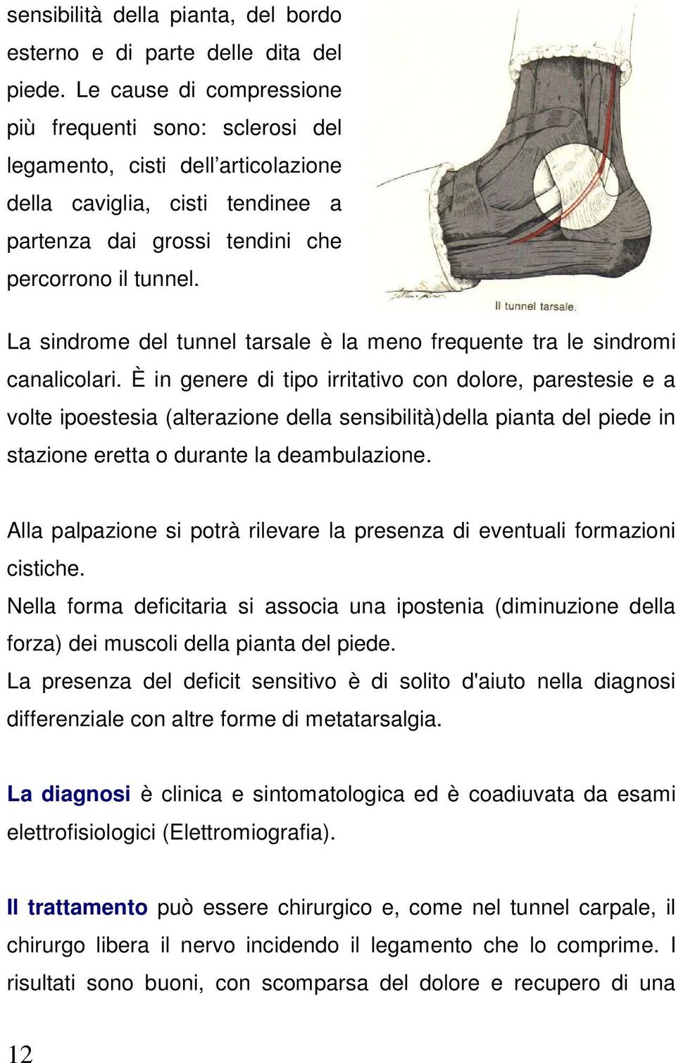 La sindrome del tunnel tarsale è la meno frequente tra le sindromi canalicolari.