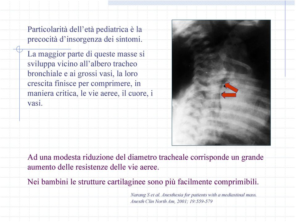 comprimere, in maniera critica, le vie aeree, il cuore, i vasi.