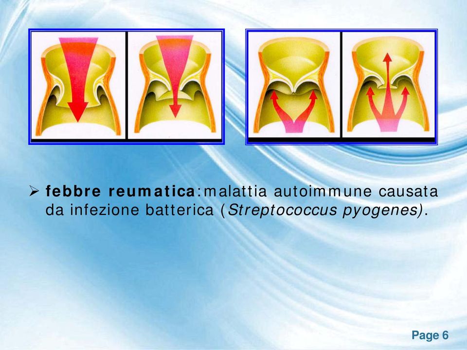 autoimmune causata da