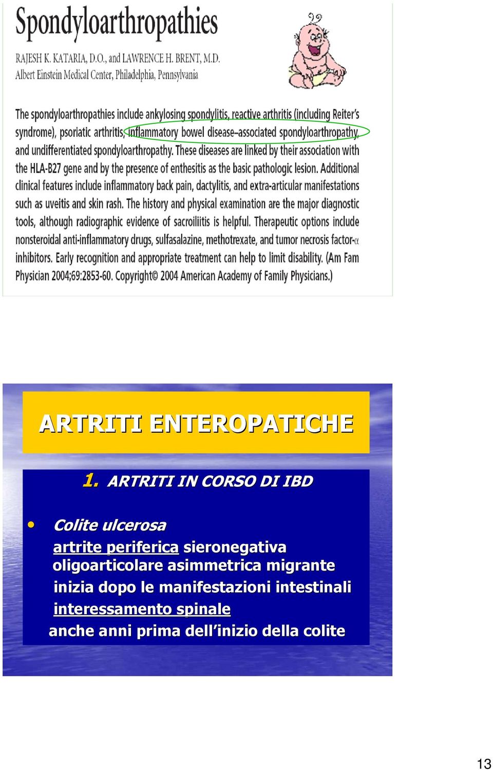 sieronegativa oligoarticolare asimmetrica migrante inizia