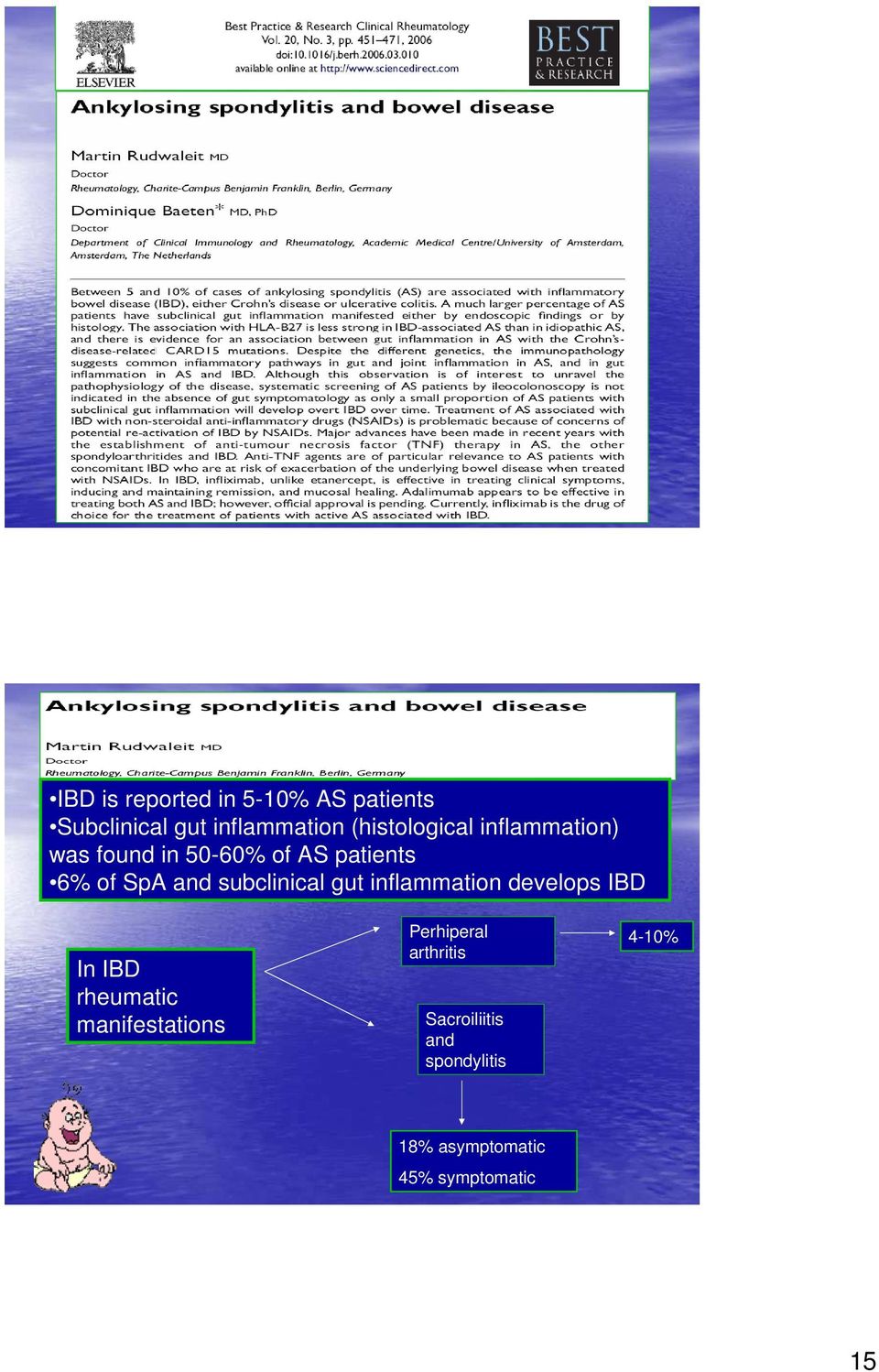 subclinical gut inflammation develops IBD In IBD rheumatic manifestations