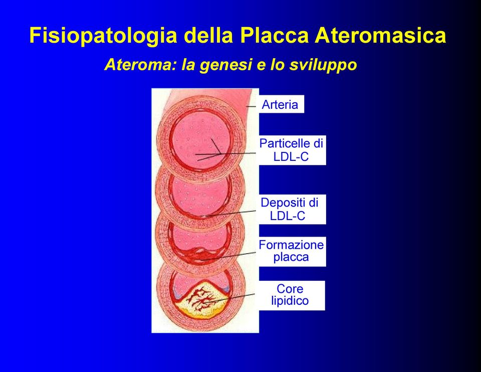 sviluppo Arteria Particelle di LDL-C