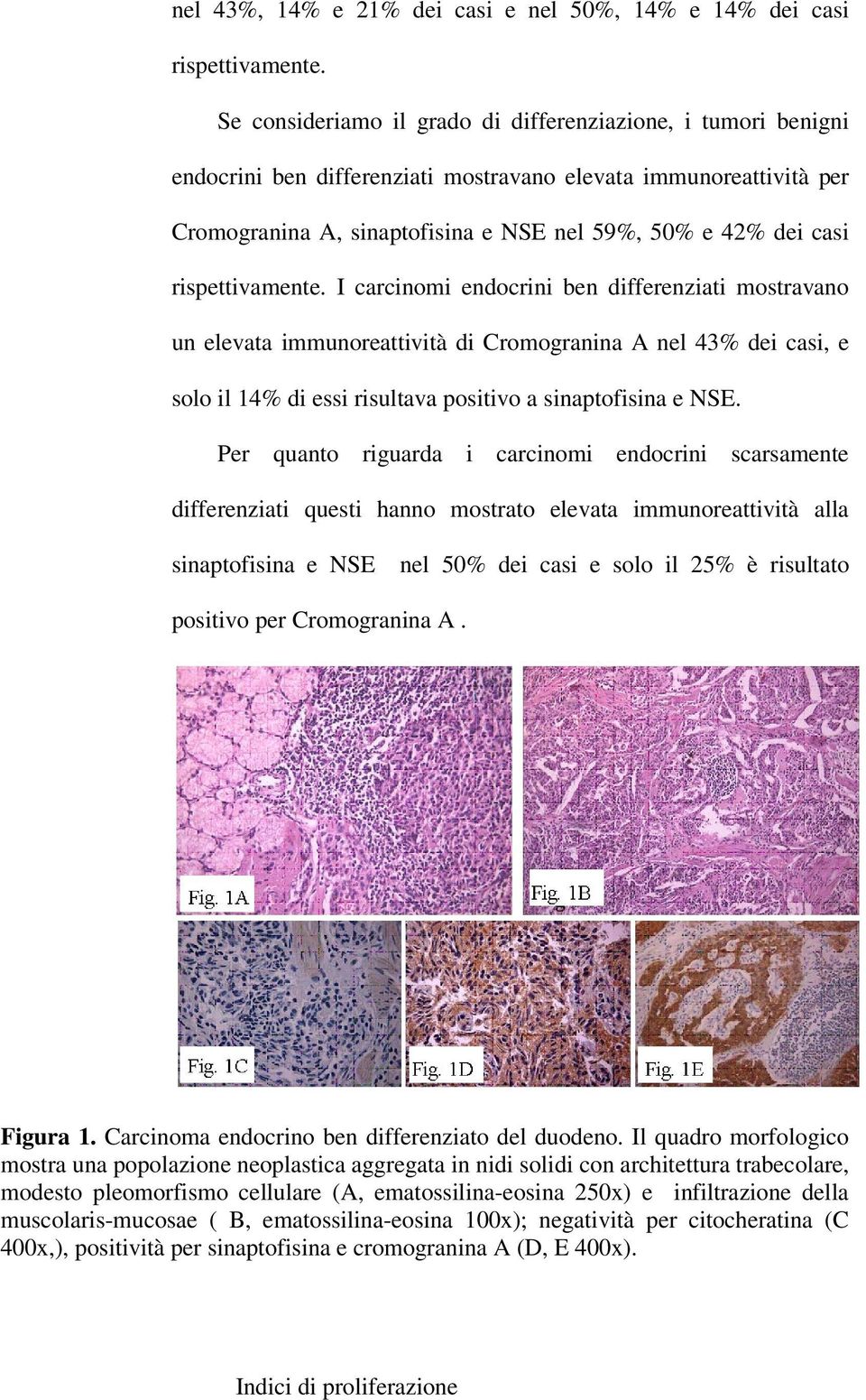 rispettivamente. I carcinomi endocrini ben differenziati mostravano un elevata immunoreattività di Cromogranina A nel 43% dei casi, e solo il 14% di essi risultava positivo a sinaptofisina e NSE.