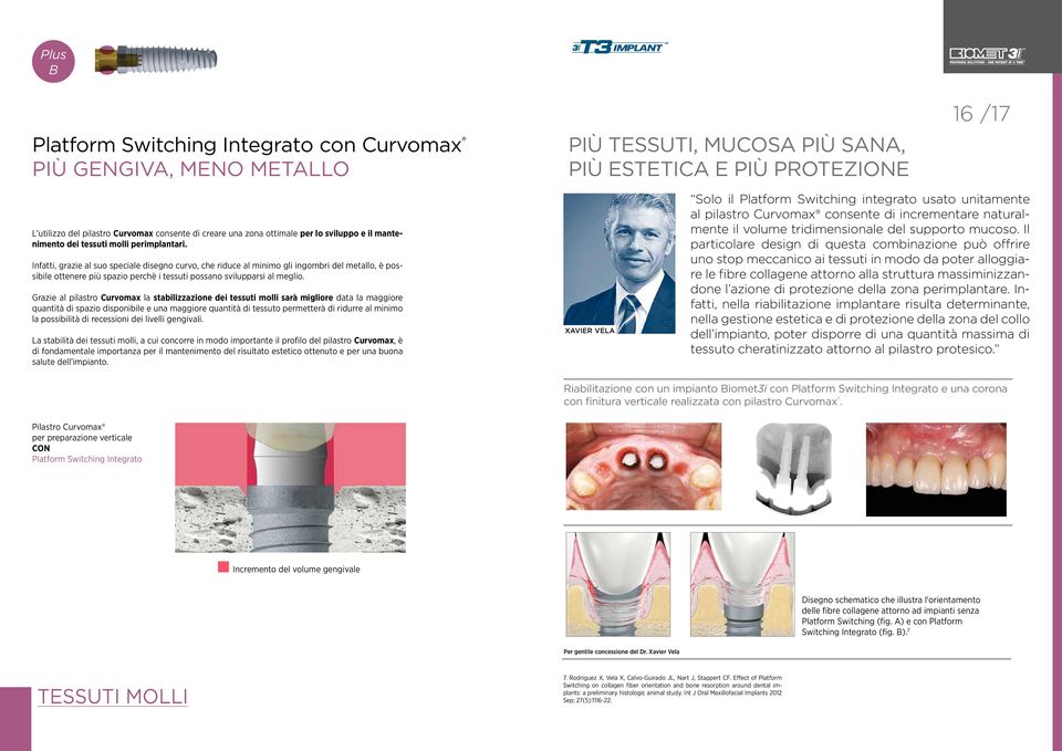 Infatti, grazie al suo speciale disegno curvo, che riduce al minimo gli ingombri del metallo, è possibile ottenere più spazio perchè i tessuti possano svilupparsi al meglio.