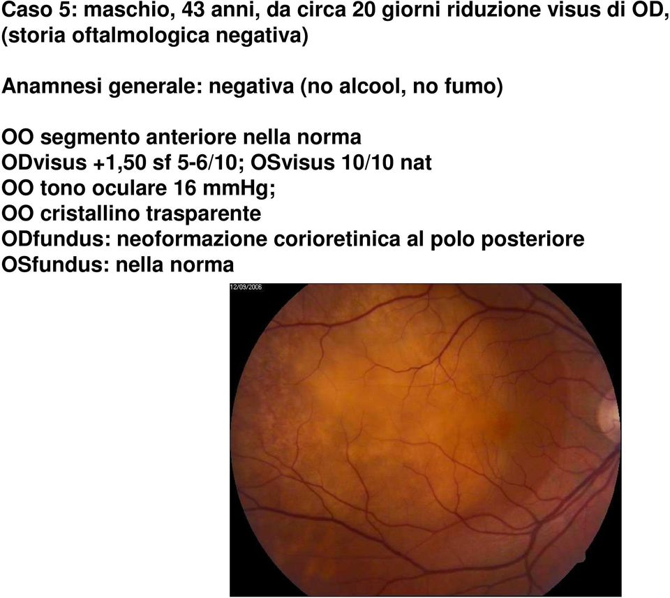 anteriore nella norma ODvisus +1,50 sf 5-6/10; OSvisus 10/10 nat OO tono oculare 16