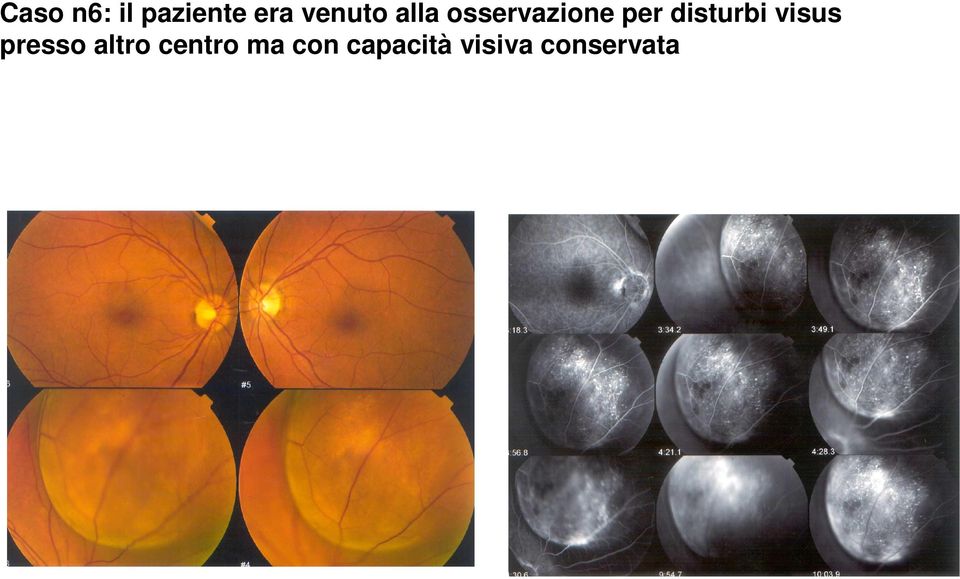 disturbi visus presso altro