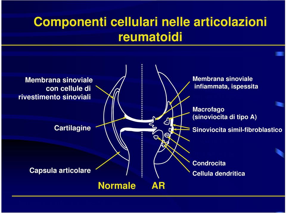 (sinoviocita di tipo A) Cartilagine Sinoviocita simil-fibroblastico Capsula articolare