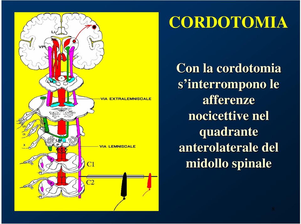 nocicettive nel quadrante