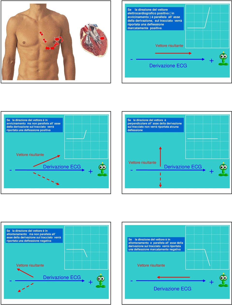 direzione del vettore è perpendicolare all asse della derivazione sul tracciato non verrà riportata alcuna deflessione Vettore risultante Derivazione ECG - Vettore risultante - Derivazione ECG Se la