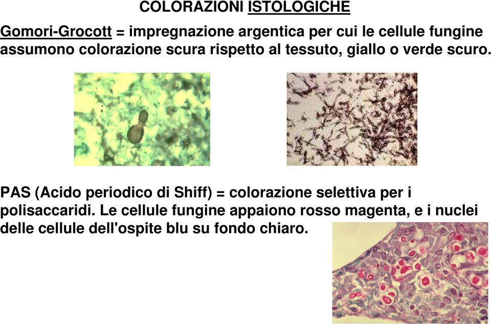 PAS (Acido periodico di Shiff) = colorazione selettiva per i polisaccaridi.