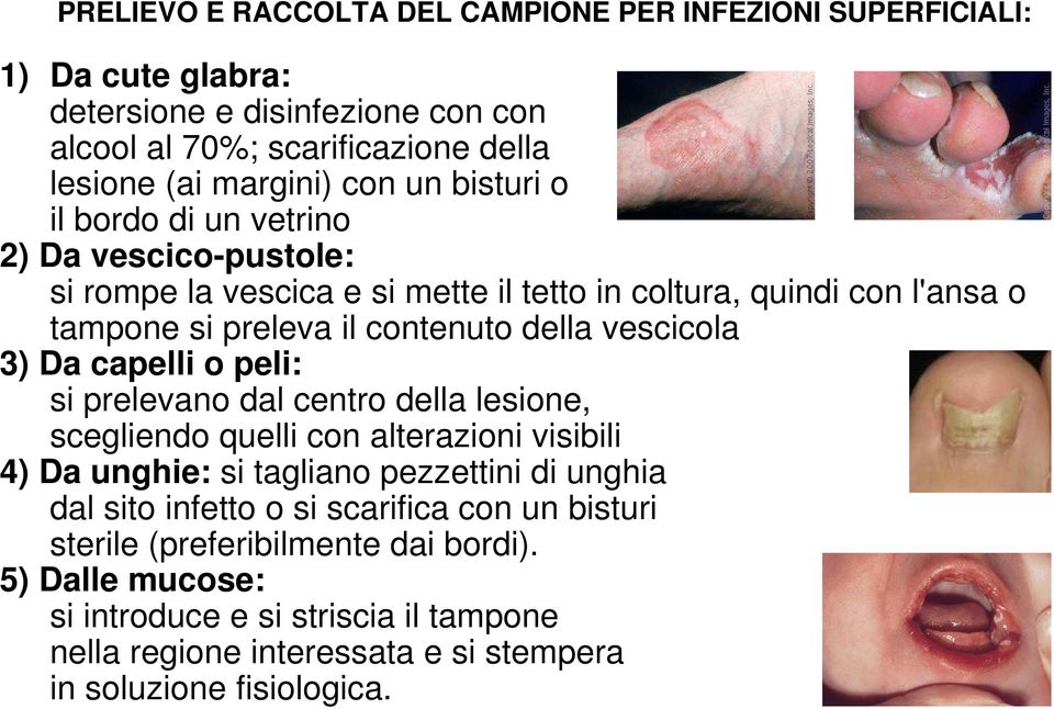 3) Da capelli o peli: si prelevano dal centro della lesione, scegliendo quelli con alterazioni visibili 4) Da unghie: si tagliano pezzettini di unghia dal sito infetto o si