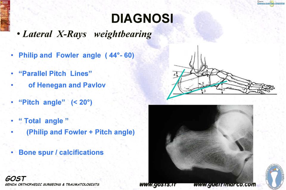 Parallel Pitch Lines! of Henegan and Pavlov!