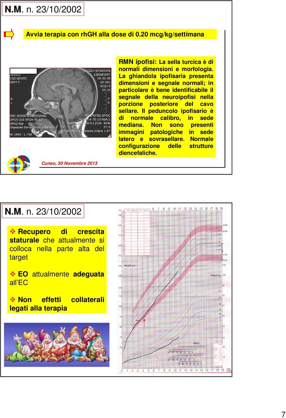 peduncolo ipofisario è di normale calibro, in sede mediana Non sono presenti immagini patologiche in sede latero e sovrasellare Normale configurazione delle strutture