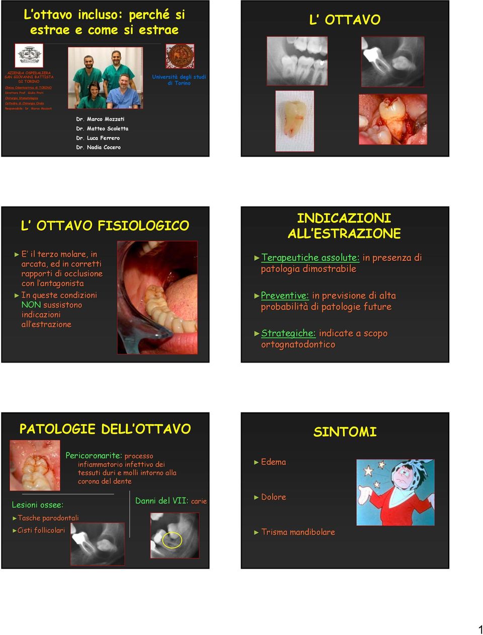 Nadia Cocero L OTTAVO FISIOLOGICO E il terzo molare, in arcata, ed in corretti rapporti di occlusione con l antagonistal In queste condizioni NON sussistono indicazioni all estrazione INDICAZIONI ALL