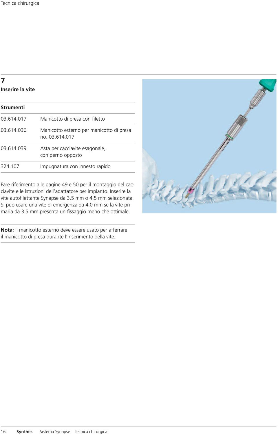 Inserire la vite autofilettante Synapse da 3.5 mm o 4.5 mm selezionata. Si può usare una vite di emergenza da 4.0 mm se la vite primaria da 3.