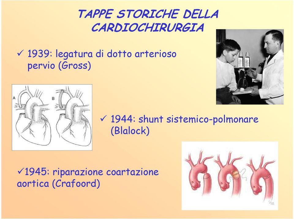 1944: shunt sistemico-polmonare (Blalock)