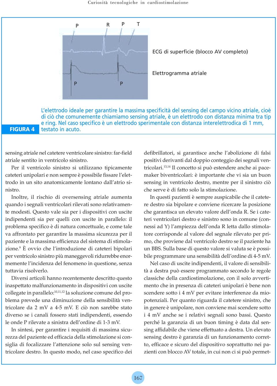 Nel caso specifico è un elettrodo sperimentale con distanza interelettrodica di 1 mm, testato in acuto.