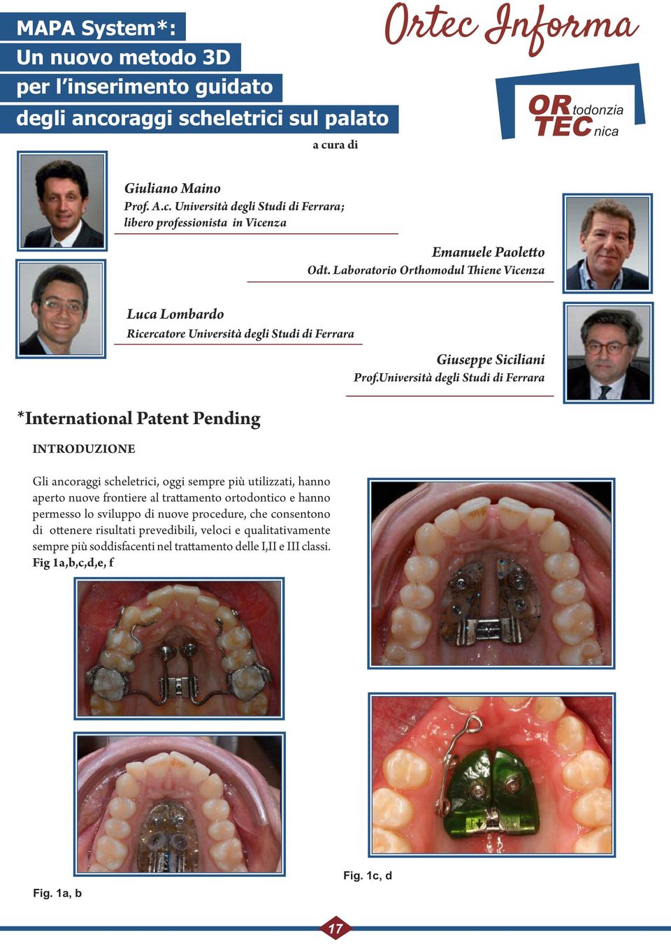 hanno aperto nuove frontiere al trattamento ortodontico e hanno permesso lo sviluppo di nuove procedure, che consentono di ottenere risultati prevedibili, veloci e qualitativamente sempre più