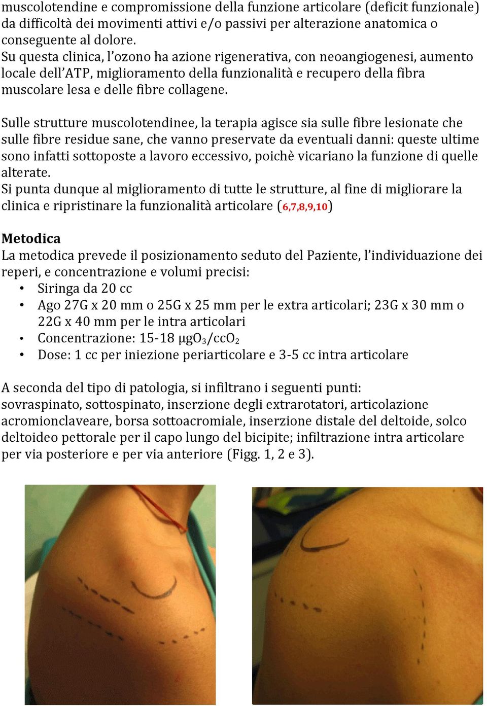 Sulle strutture muscolotendinee, la terapia agisce sia sulle fibre lesionate che sulle fibre residue sane, che vanno preservate da eventuali danni: queste ultime sono infatti sottoposte a lavoro