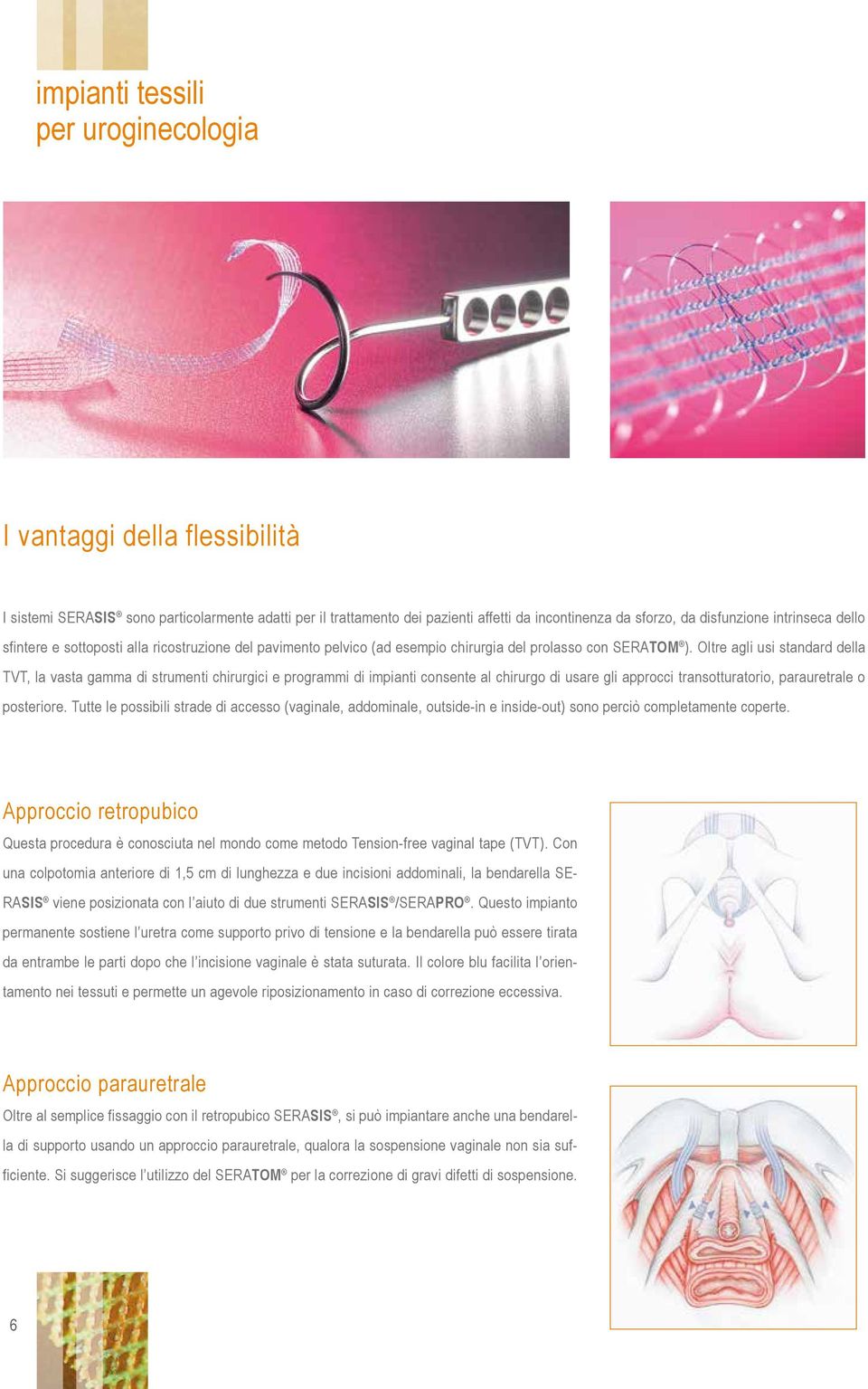 Oltre agli usi standard della TVT, la vasta gamma di strumenti chirurgici e programmi di impianti consente al chirurgo di usare gli approcci transotturatorio, parauretrale o posteriore.