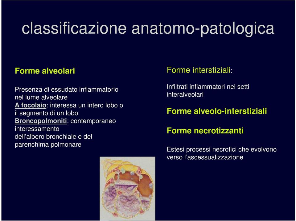 albero bronchiale e del parenchima polmonare Forme interstiziali: Infiltrati infiammatori nei setti