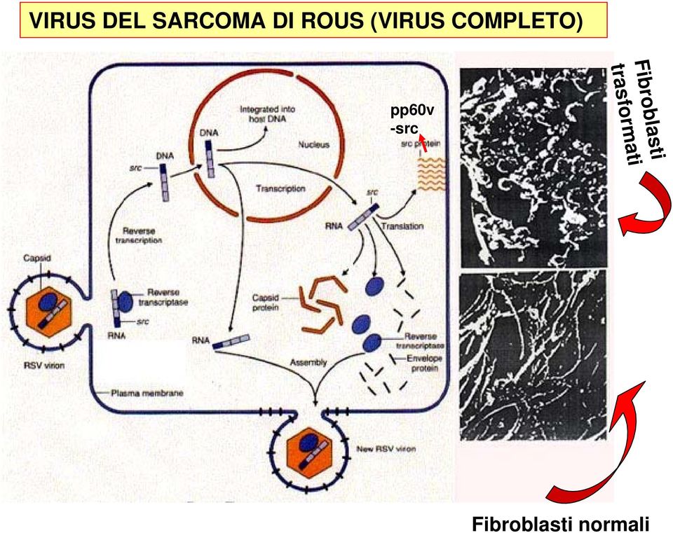 Fibroblasti trasformati