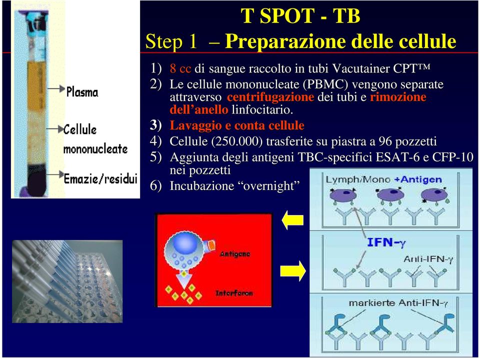 anello linfocitario. 3) Lavaggio e conta cellule 4) Cellule (250.