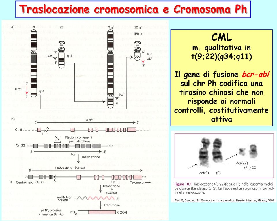 bcr-abl sul chr Ph codifica una tirosino chinasi che