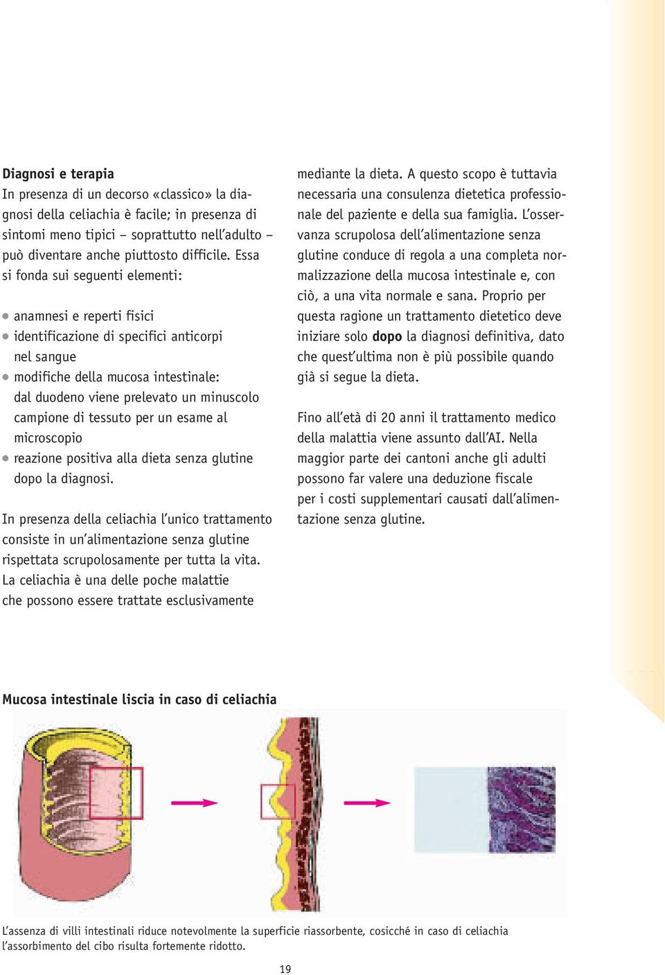 di tessuto per un esame al microscopio reazione positiva alla dieta senza glutine dopo la diagnosi.