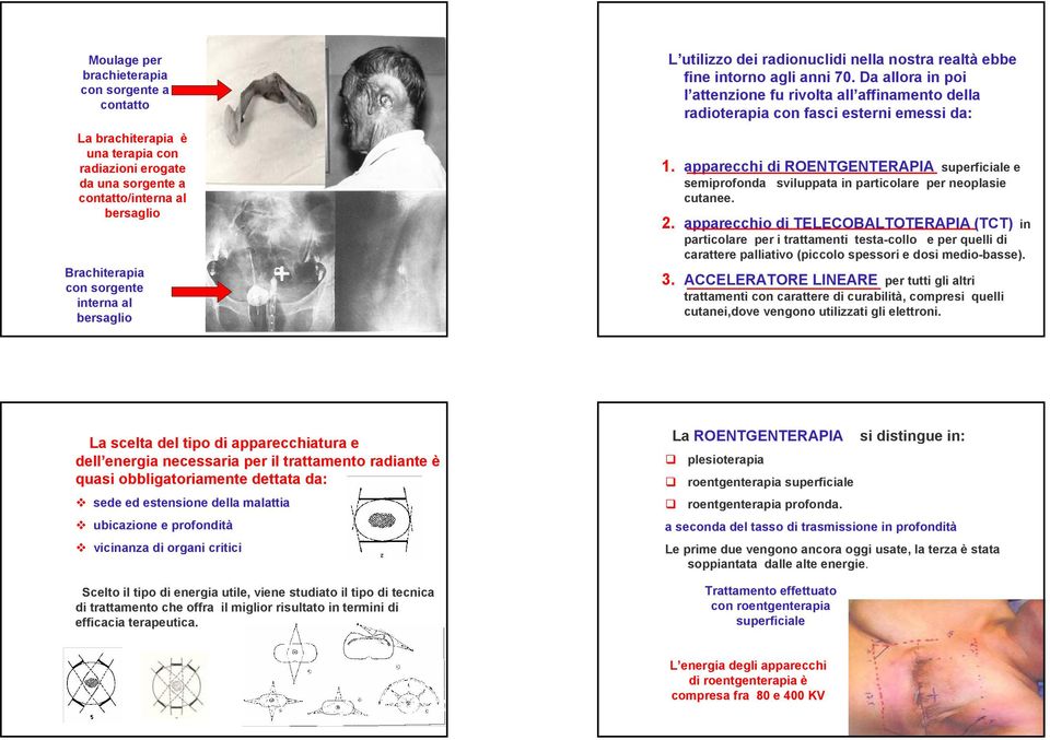 apparecchi di ROENTGENTERAPIA superficiale e semiprofonda sviluppata in particolare per neoplasie cutanee. 2.