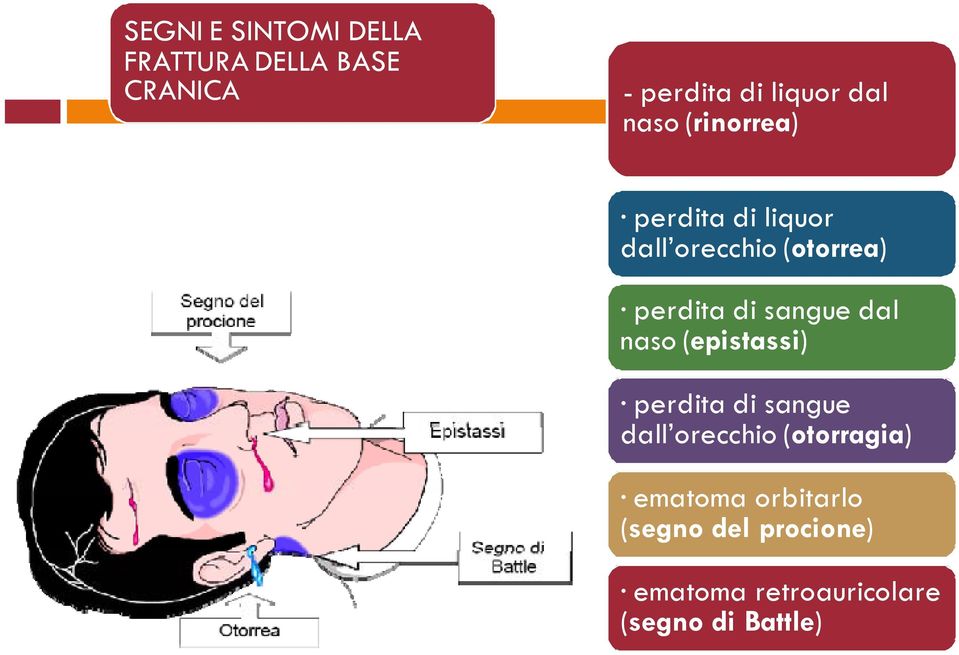 sangue dal naso (epistassi) perdita di sangue dall orecchio (otorragia)