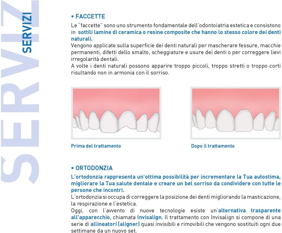 A volte i denti naturali possono apparire troppo piccoli, troppo stretti o troppo corti risultando non in armonia con il sorriso.