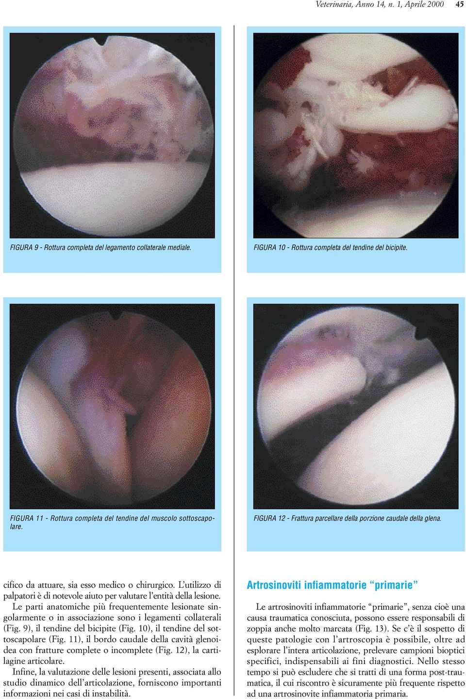 L utilizzo di palpatori è di notevole aiuto per valutare l entità della lesione. Le parti anatomiche più frequentemente lesionate singolarmente o in associazione sono i legamenti collaterali (Fig.