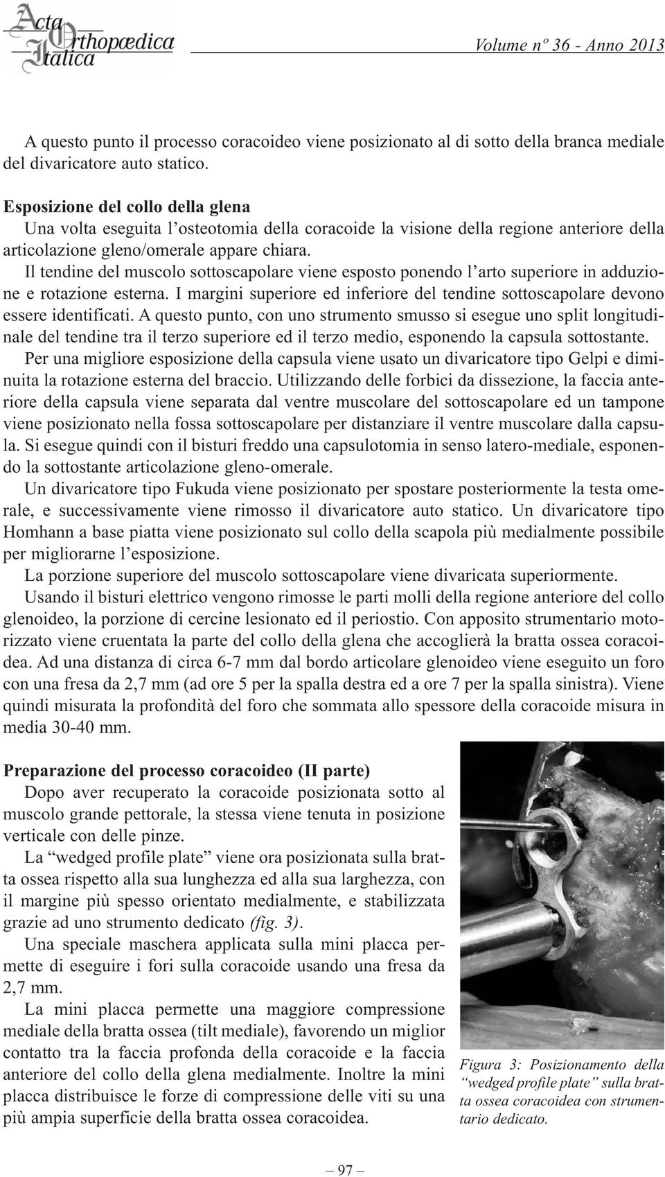 Il tendine del muscolo sottoscapolare viene esposto ponendo l arto superiore in adduzione e rotazione esterna. I margini superiore ed inferiore del tendine sottoscapolare devono essere identificati.